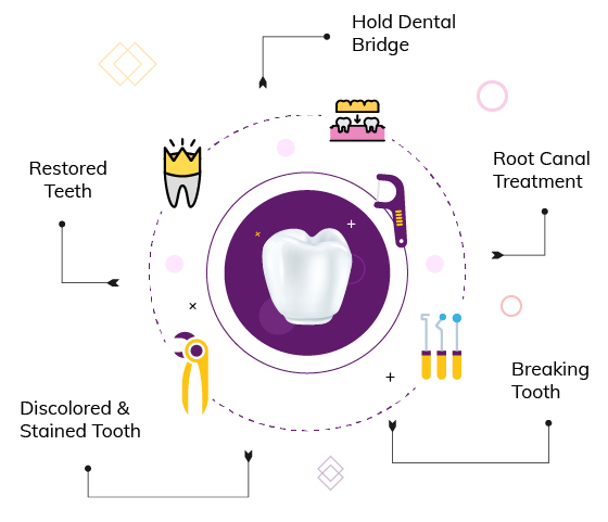 dental crowns benefits